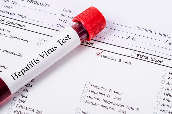 Real life struggles with hepatitis, liver cancer